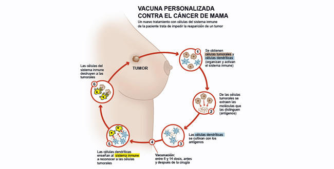 Vacuna cáncer de mama